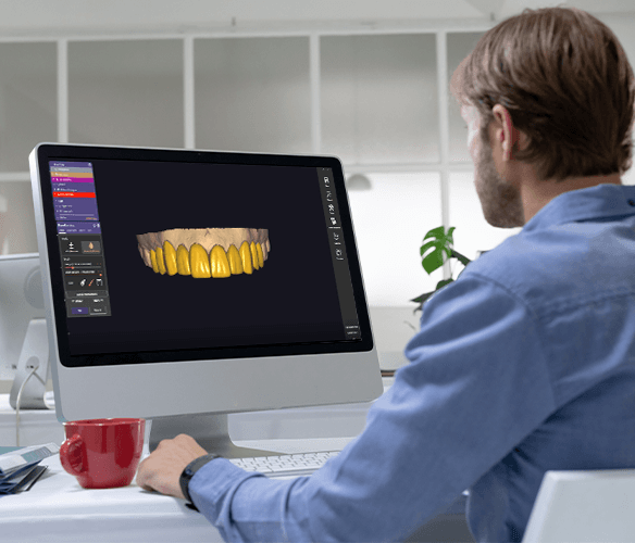 Dental Design Software