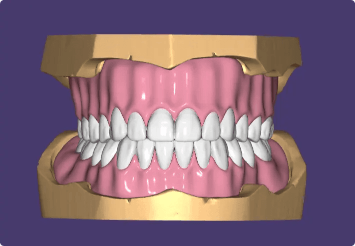Dental Design