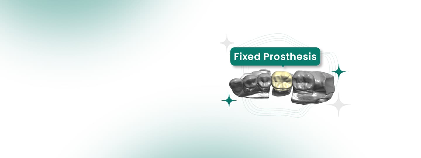 Stronger Smiles with Lasting Restorations