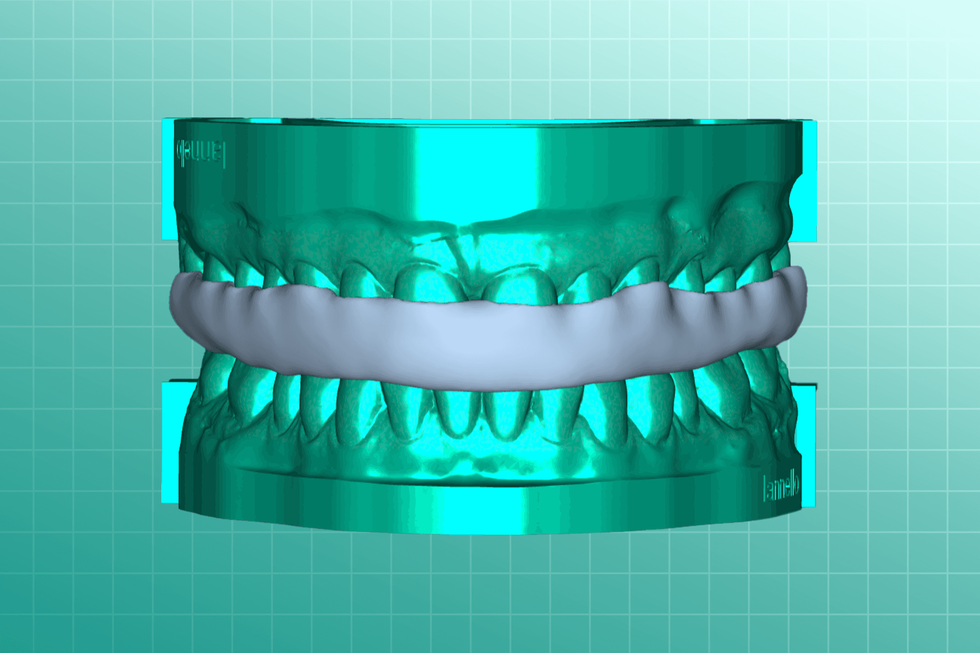 Night Guards & Splints